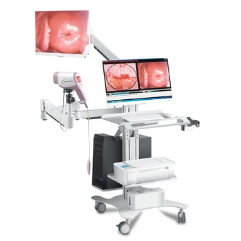 Pôvodné Dodanie Jadra KN-2200I(H) HD colposcope gynecology pošvy colposcopy 1080P digitálny video colposcope